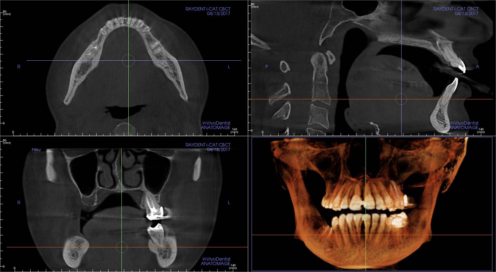 Raydent i-CAT Dental and Maxillofacial Imaging Centre